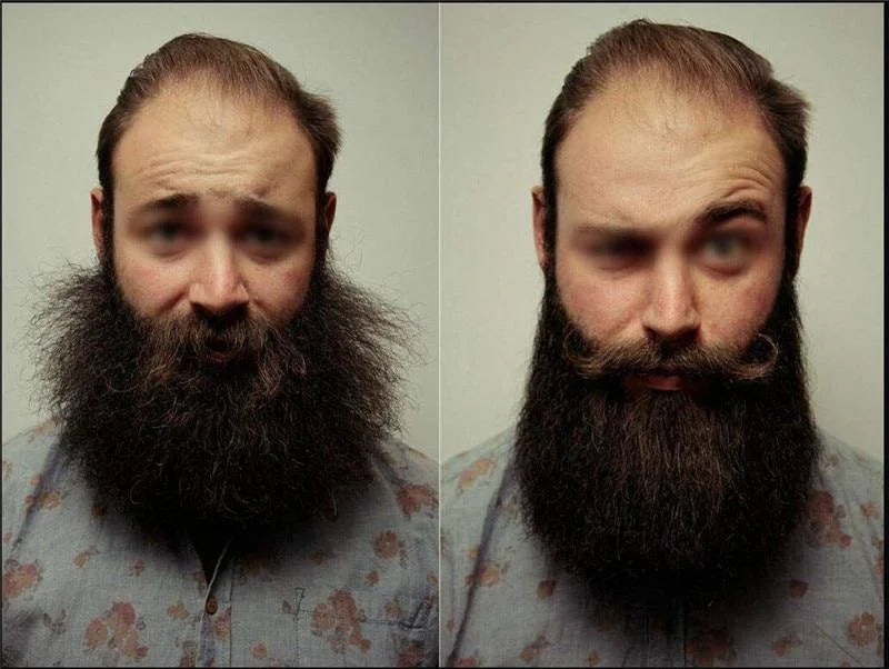 Alisador de Barba e Cabelo – CHAPINHA MASCULINA 2.0