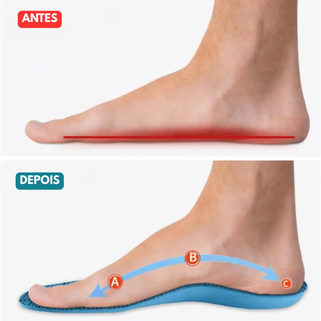 Palmilhas Revolucionárias Orthopedic - Alivio e Conforto Total